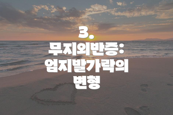 3. 무지외반증: 엄지발가락의 변형